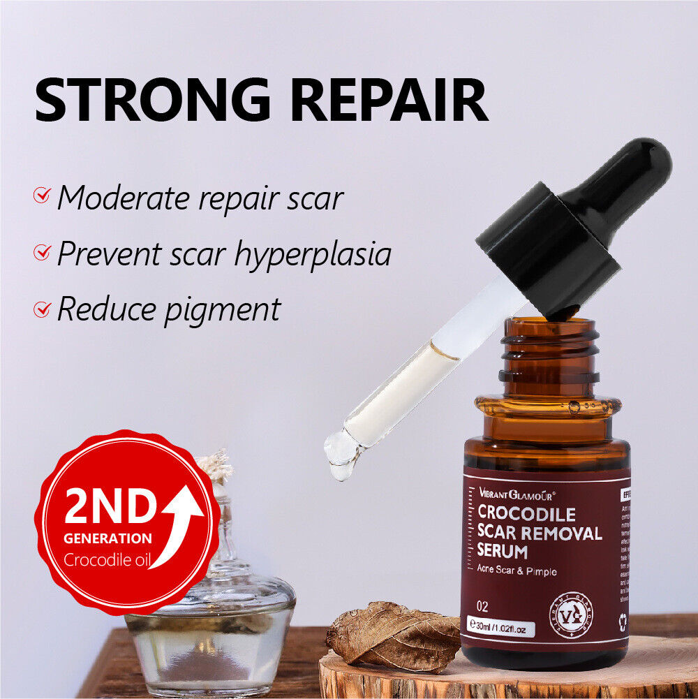 سرم رفع اسکار روغن تمساح 30 میل Vibrant Glamour